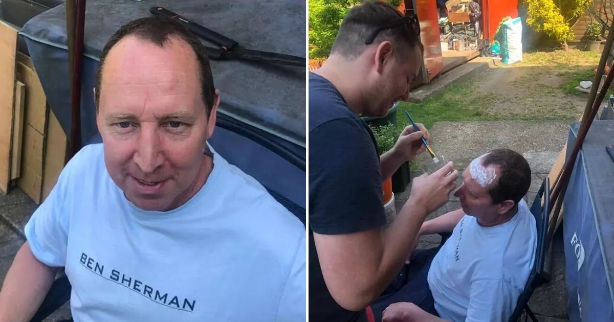 untitled design 60.jpg?resize=412,275 - Son Glued His Hair Trimmings On Dad’s Bald Spots In Home ‘Hair Transplant’