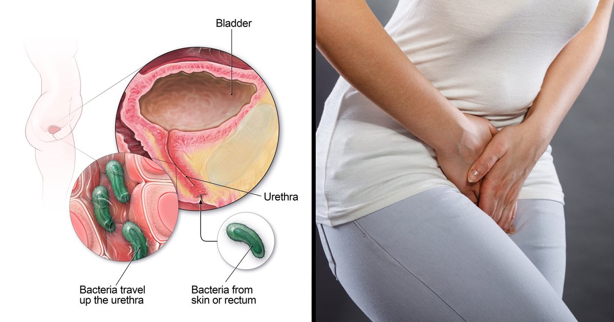 urinary tract infection.jpg?resize=412,275 - Urinary Tract Infection - Symptoms, Diagnosis and Treatment