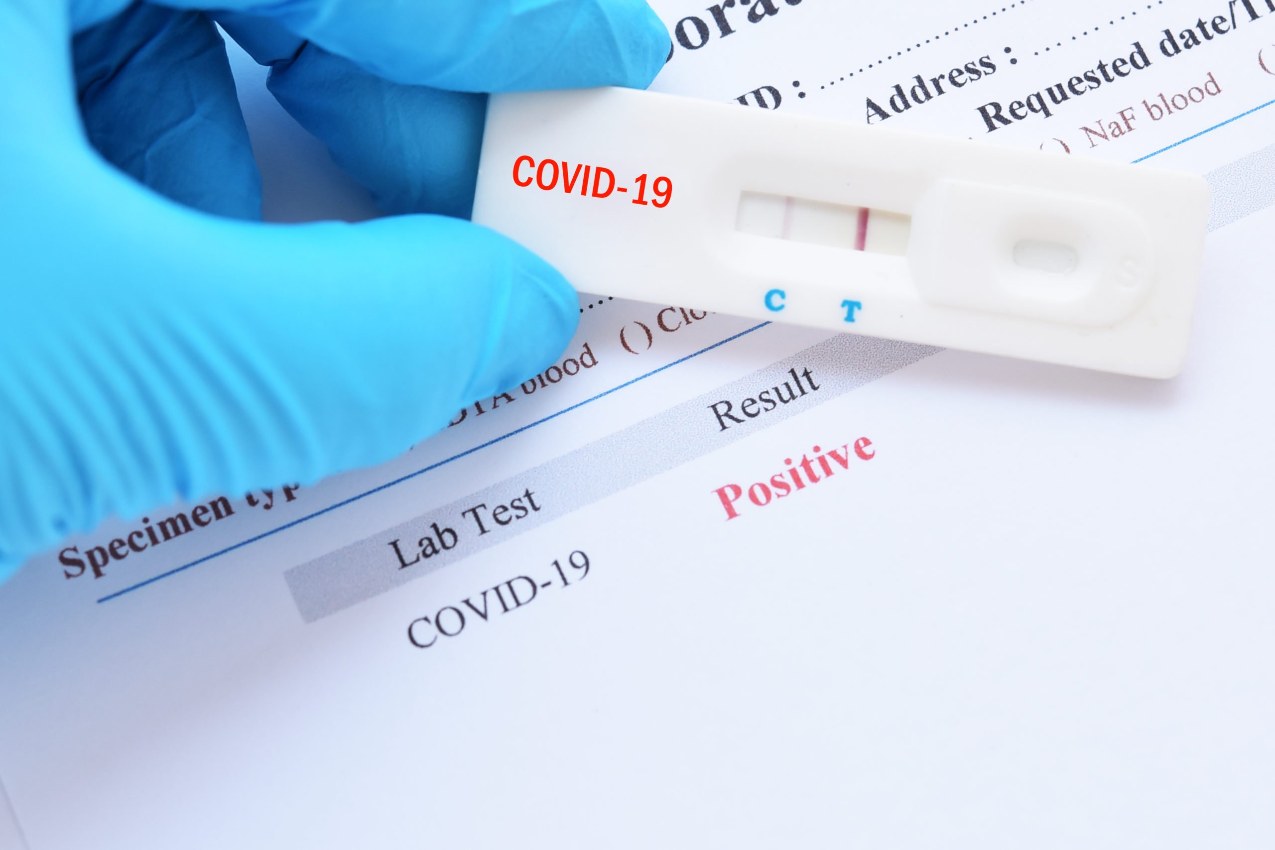 Covid-19: Sanidad reconoce que un lote de test no cuenta con ...