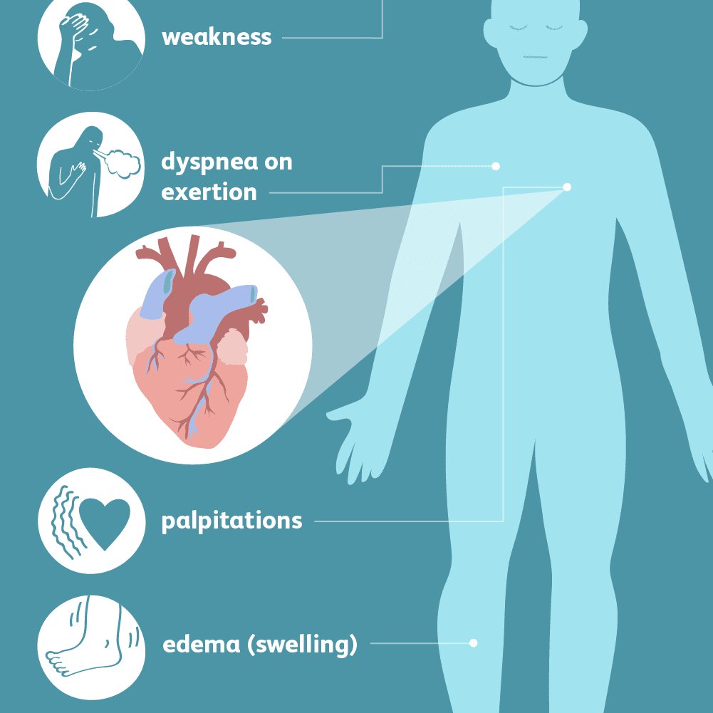 Congestive Heart Failure: Causes And Symptoms