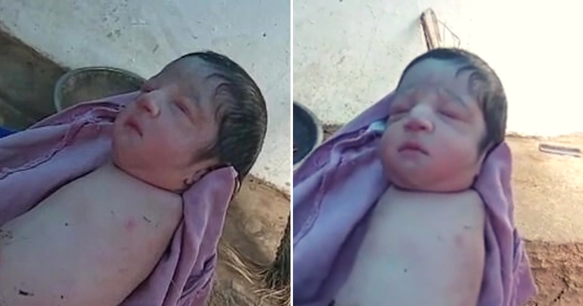 baby6.png?resize=1200,630 - Baby Girl Born With No Legs And Arms Has Left Her Family And Doctors Baffled