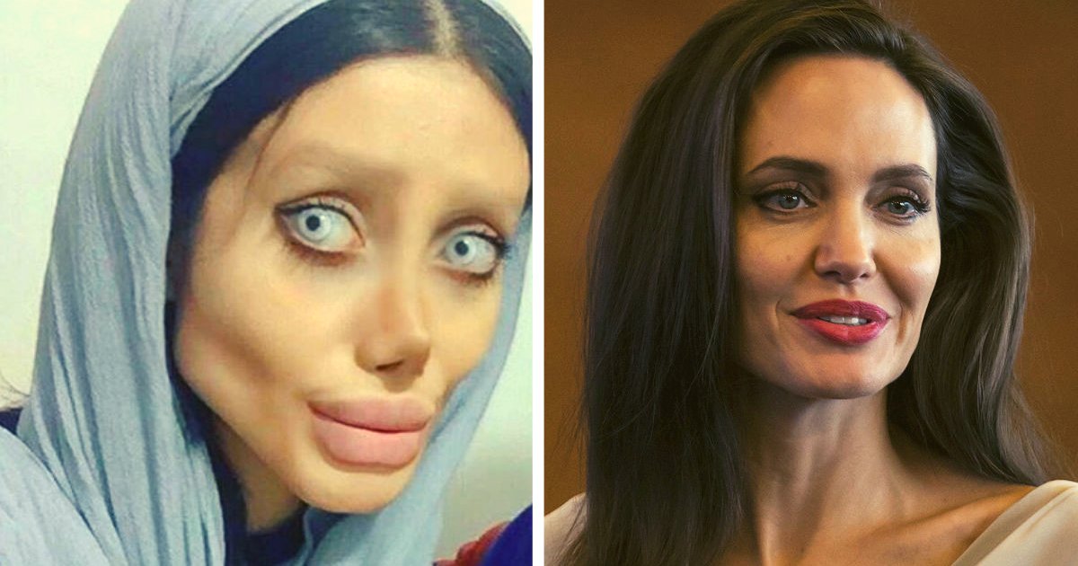 diseno sin titulo 27.png?resize=1200,630 - Mujer Se Operó Más De 40 Veces Para Parecerse A Angelina Jolie, Pero Acaba En Prisión