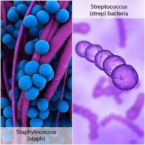 staph infection