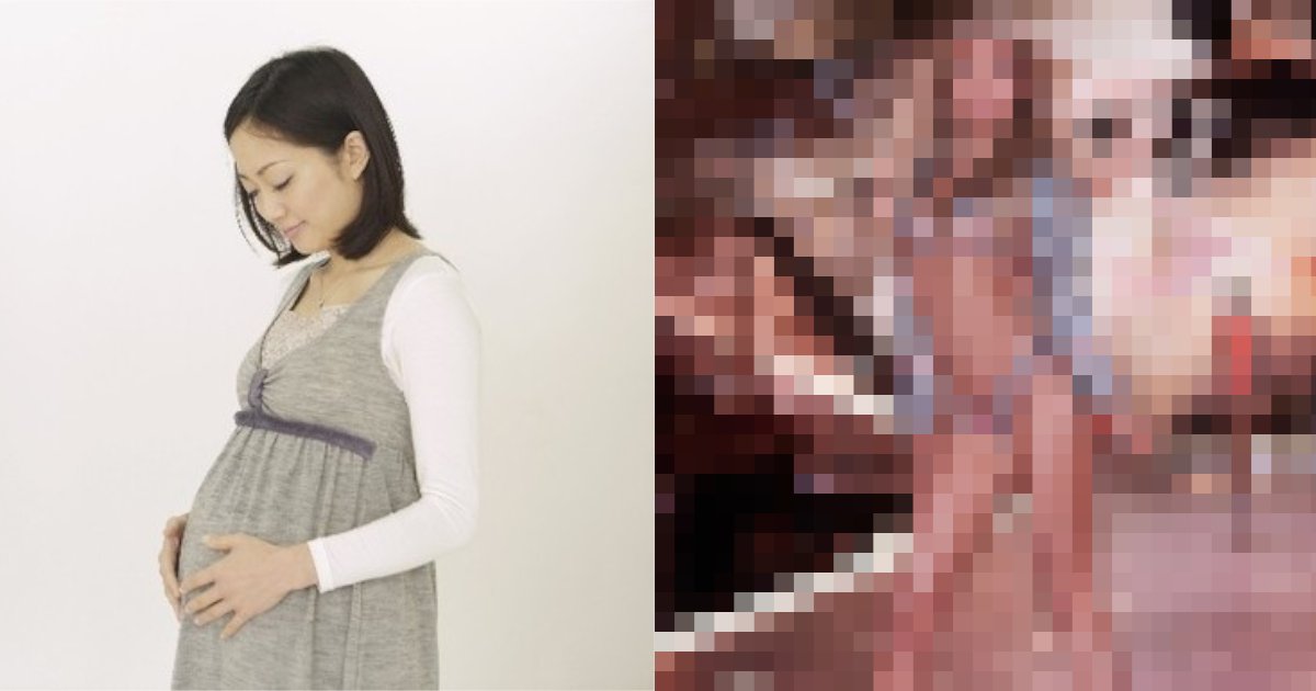 model.png?resize=412,275 - 「7年間生理が来なかった…」あの人気モデルが明かす妊娠前の苦悩を告白⁈