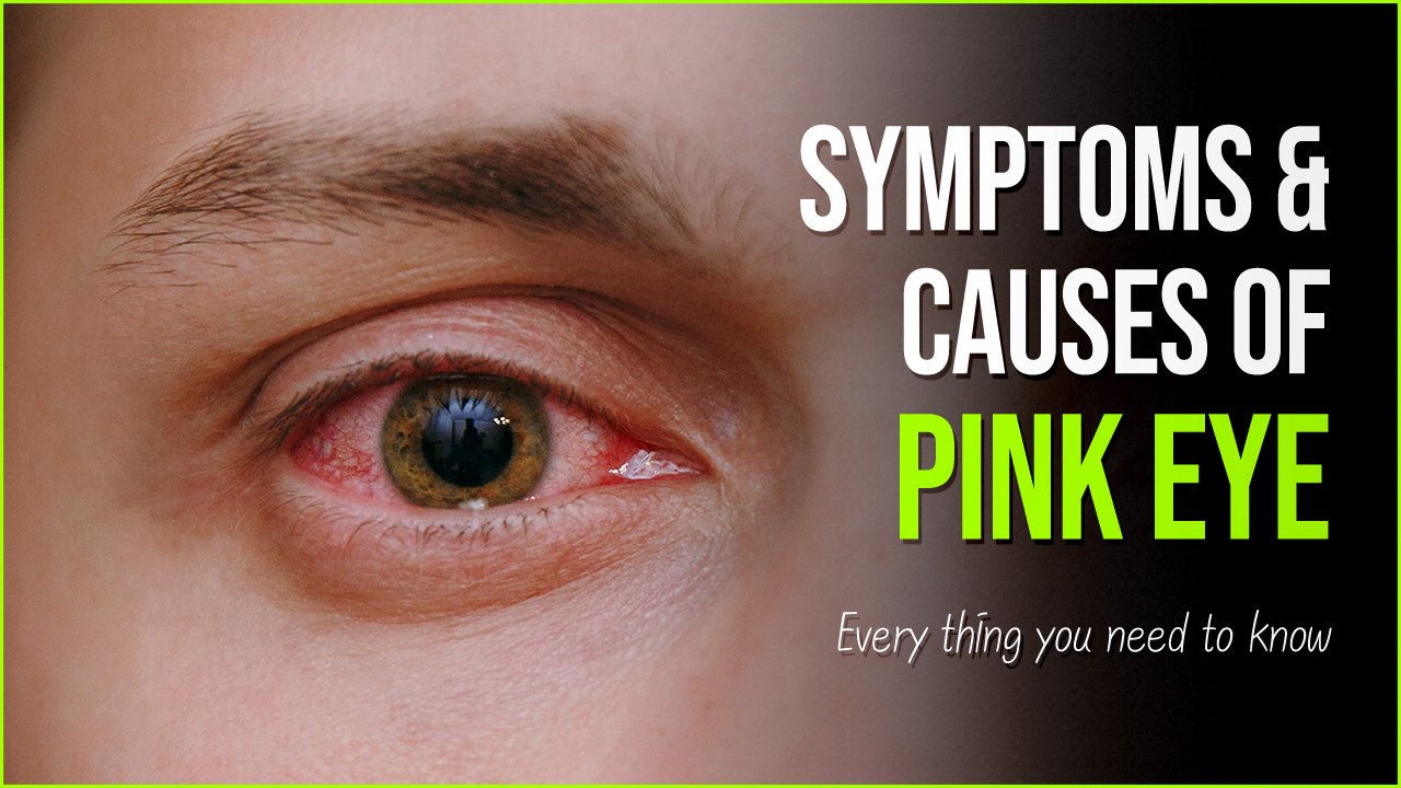 Pink Eye Symptoms Causes And Treatment of Conjunctiva