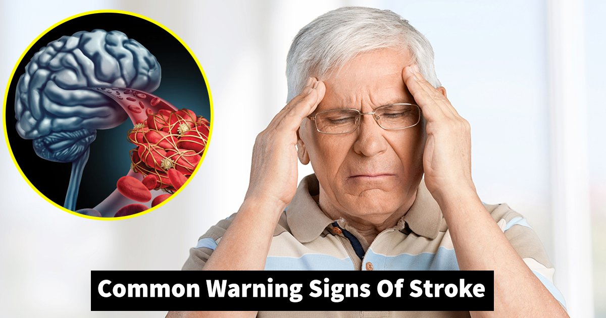 signs of stroke.jpg?resize=412,275 - Common Warning Signs Of Stroke That Shouldn't Be Ignored