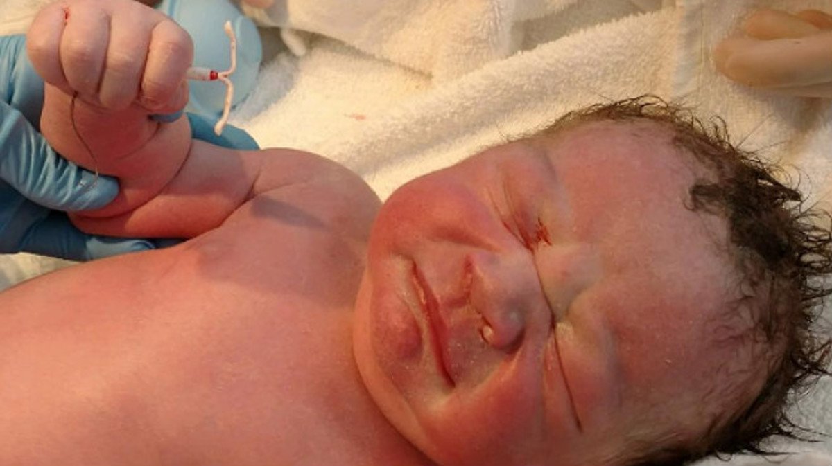 Una madre comparte la foto de su bebé, nacido con un DIU en la mano