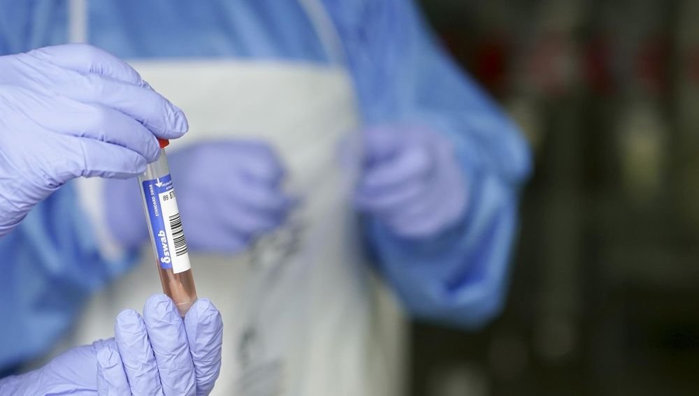 China detecta restos de coronavirus en las gambas congeladas de ...