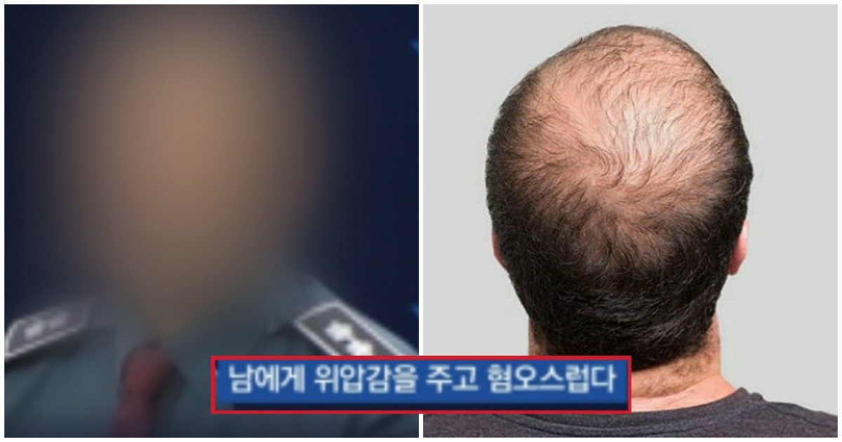 6 8.jpg?resize=1200,630 - "너 탈모야? 머리가 왜 그래 혐오스러워"... 탈모인을 무시한 직장상사의 '충격적인' 정체.jpg