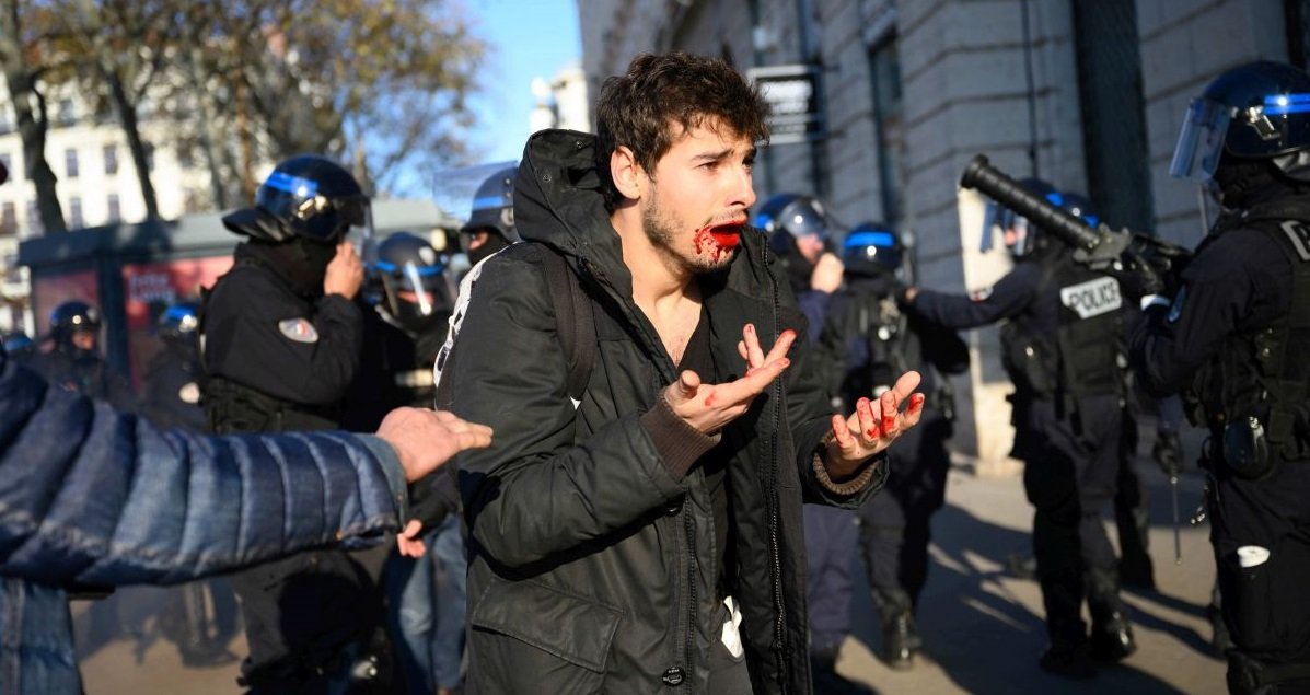 arthur.jpg?resize=1200,630 - Lyon: deux agents renvoyés en correctionnelle pour avoir violemment frappé un manifestant