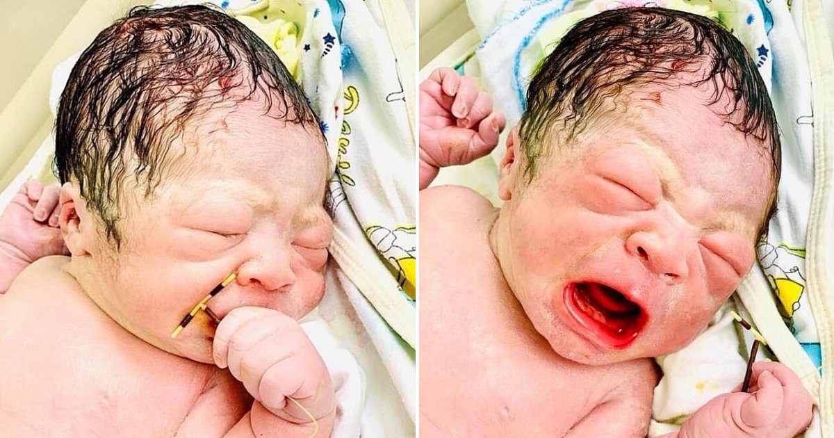 baby4.png?resize=412,275 - Photos Of Newborn Baby Holding Mother's Failed Contraceptive Coil Went Viral