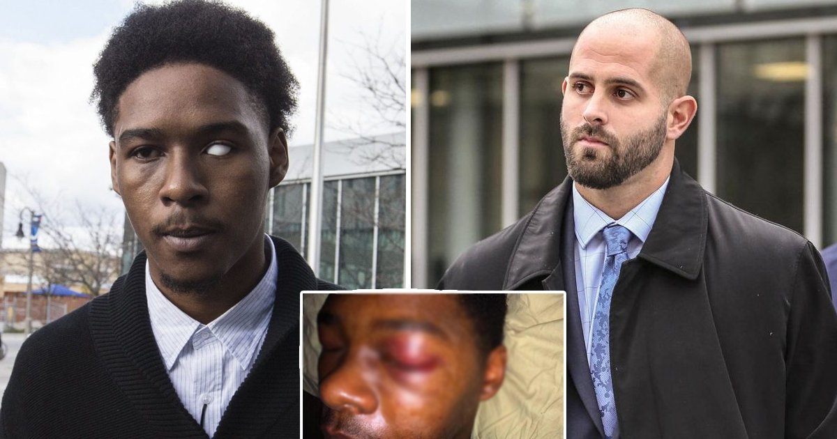 black guy beaten.jpg?resize=412,275 - Brutal Assault: Toronto Cop Convicted For Crime That Left Black Man Without An Eye