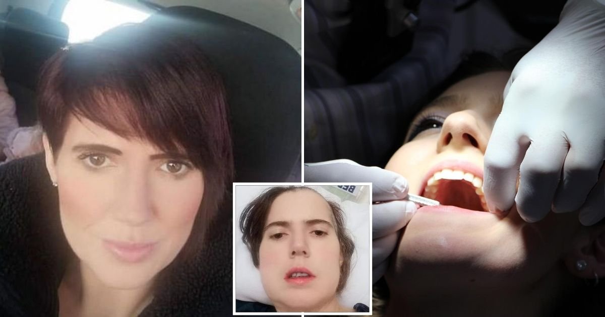 brain4.jpg?resize=412,275 - 35-Year-Old Mother Shared How A 'Tooth Abscess Almost Killed Me'