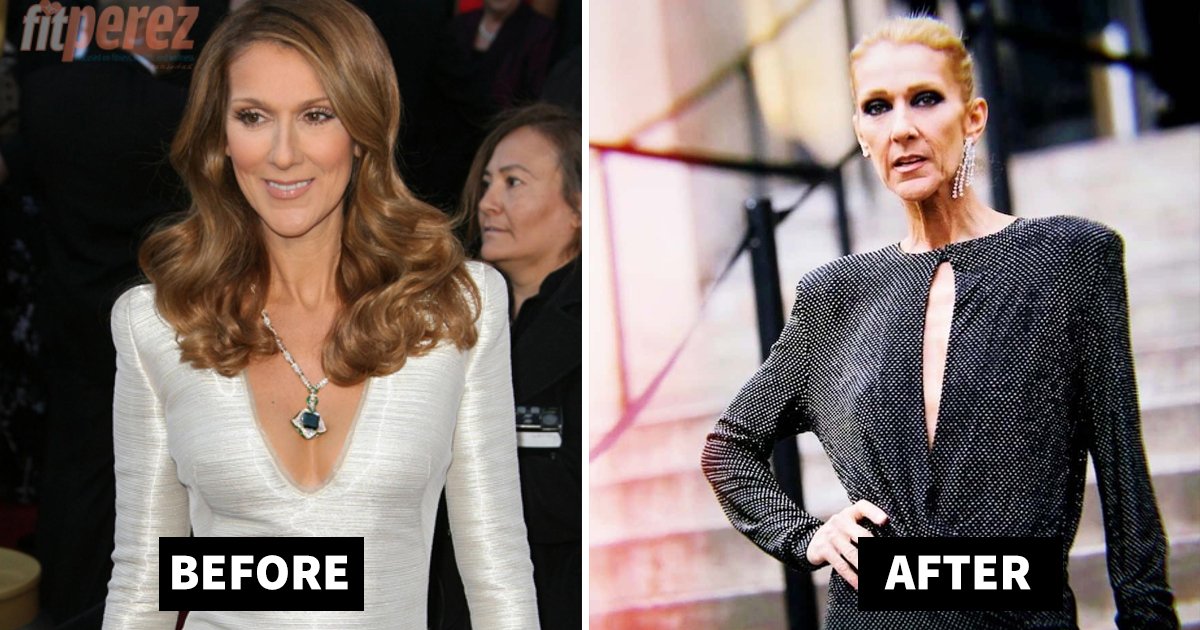 drastic celine dion weight loss.jpg?resize=412,275 - Drastic Celine Dion Weight Loss Transformation Has Fans Worried