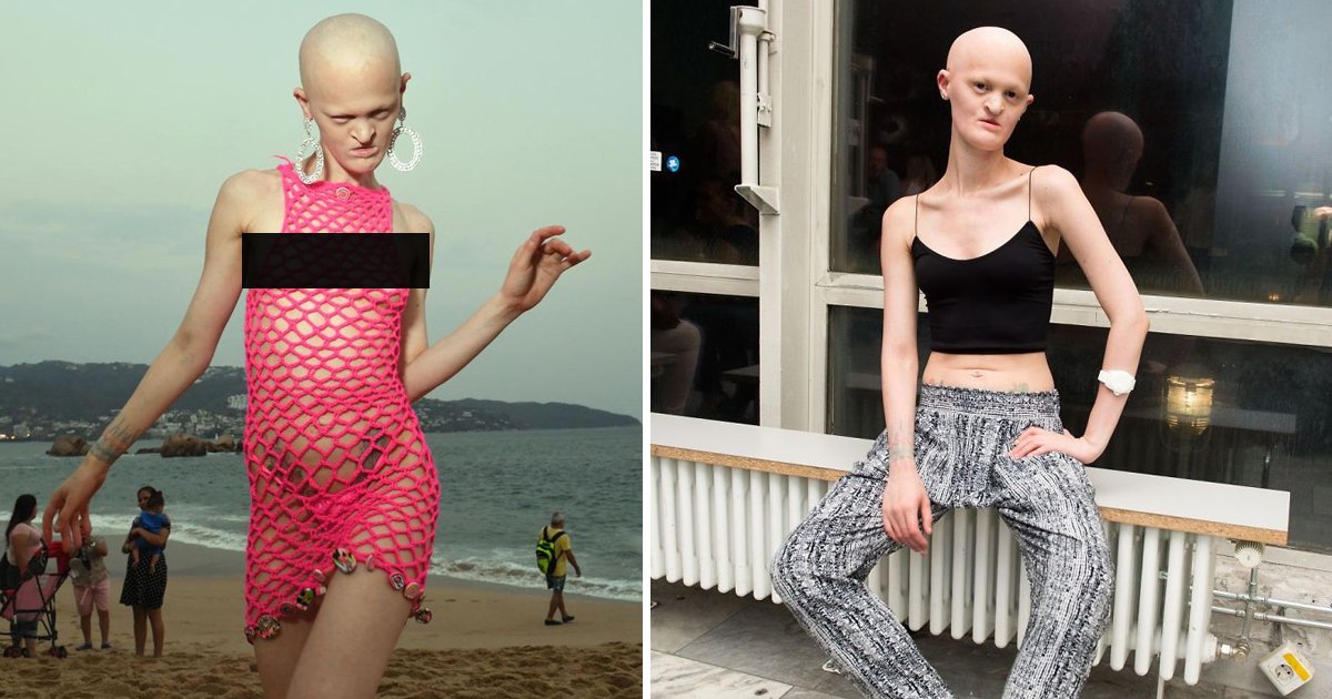 melanie gaydos 1.jpg?resize=1200,630 - Melanie Gaydos- A Brave Fashion Model That’s Breaking Stereotypes