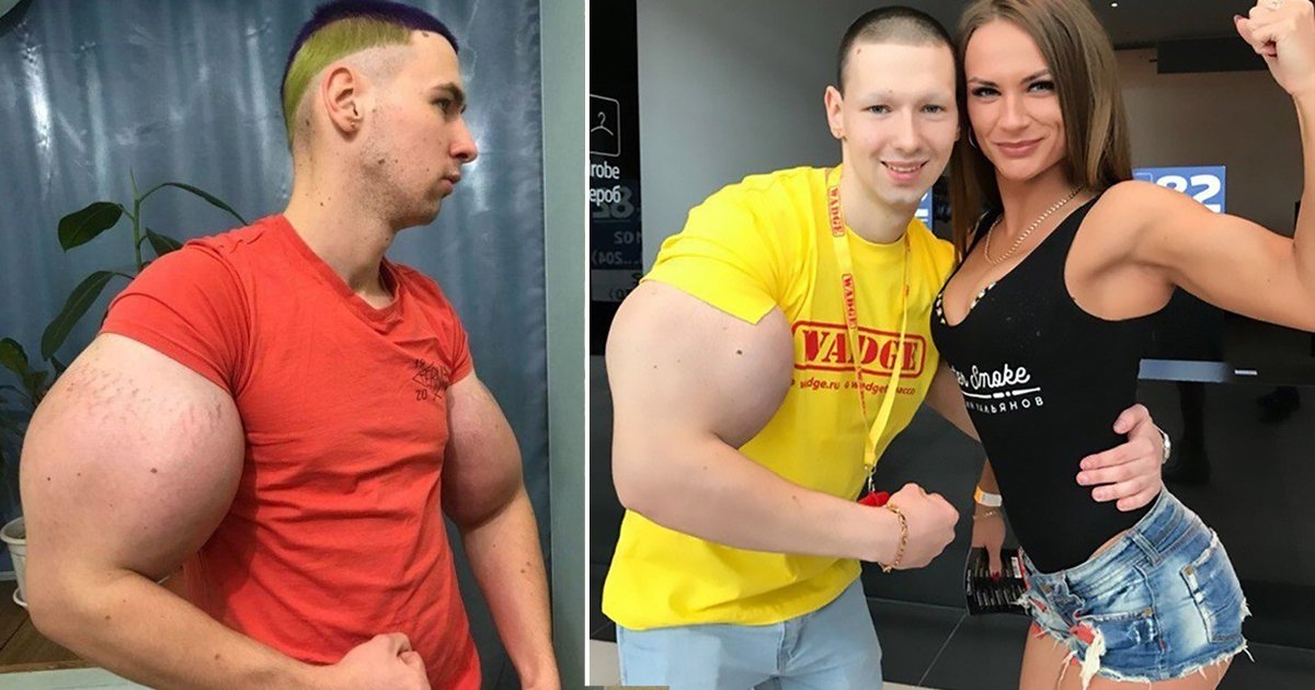 real life popye.jpg?resize=412,275 - Meet Kirill Tereshin- Real Life Popeye Who Injected Synthol In His Cheeks