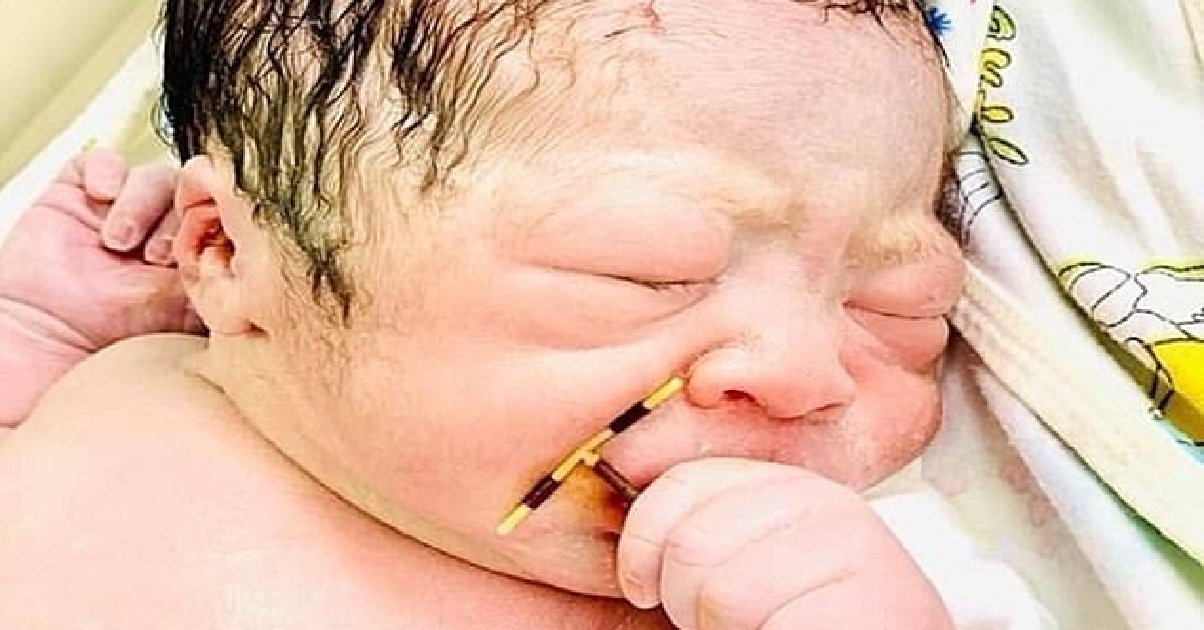 sterilet.jpg?resize=412,275 - Insolite: un bébé est né avec le stérilet de sa mère à la main