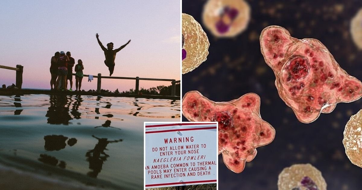 untitled design 15.jpg?resize=412,275 - Medical Alert Issued After Deadly Brain-Eating Amoeba Infects A Resident