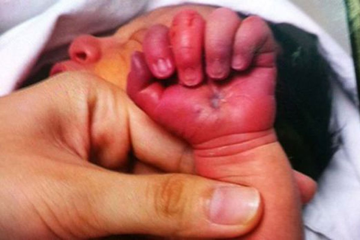 Asia: China: madre intentó comerse a su hijo recién nacido ...
