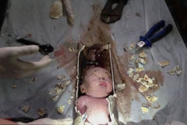 Bomberos en China rescatan, de las tuberías, a bebe que fue tirado ...