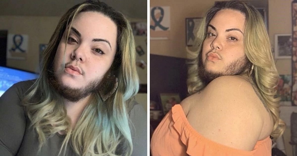 beard6.jpg?resize=412,275 - Woman Finally Embraces Her Beard After Years Of Shaving And Waxing