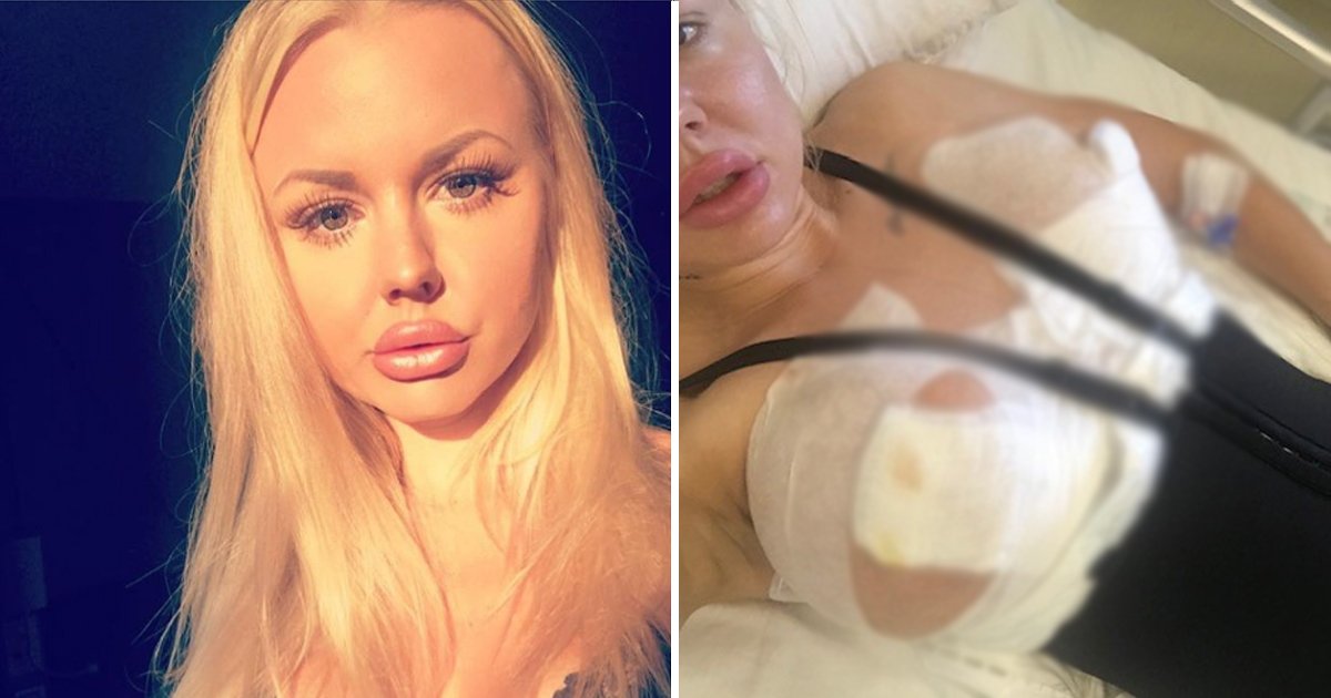 breast implant.jpg?resize=1200,630 - Woman’s £6000 Botched Breast Implants ‘Fall Out Of Her Chest’