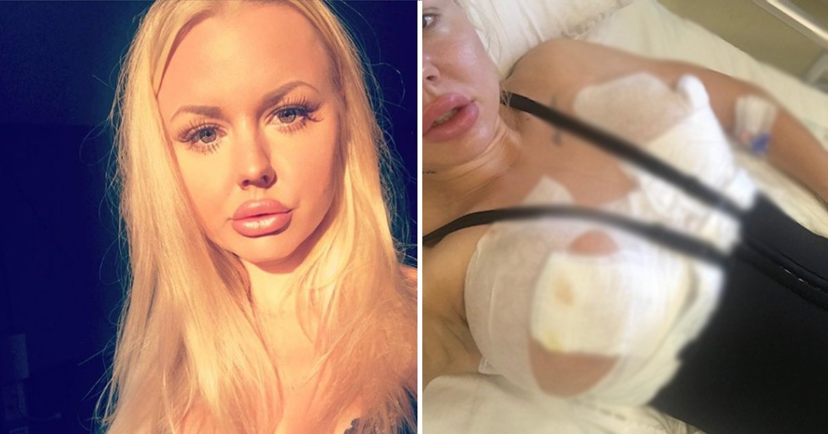 breast implant.jpg?resize=412,275 - Woman’s £6000 Botched Breast Implants ‘Fall Out Of Her Chest’