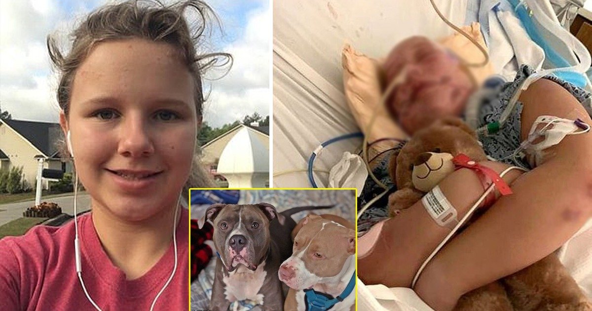 c.jpeg?resize=1200,630 - Teen Girl Fights For Life After Neighbor's Pitbulls Rip Off Scalp, Ear, And Injure Throat