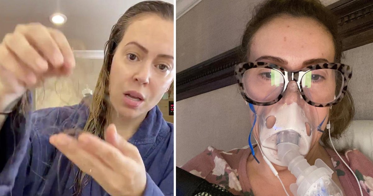 hair loss.jpg?fit=1024%2C538&ssl=1&strip=all - Actress Alyssa Milano Is Suffering From Drastic Hair Loss After Battle Against COVID-19