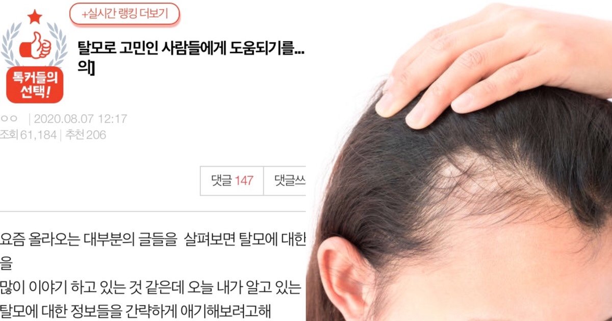 kakaotalk 20200808 010040482.jpg?resize=412,275 - 모발 성형외과 직원이 알려주는 "탈모로 고민인 사람들에게 도움 될 '꿀팁'" (스압주의)