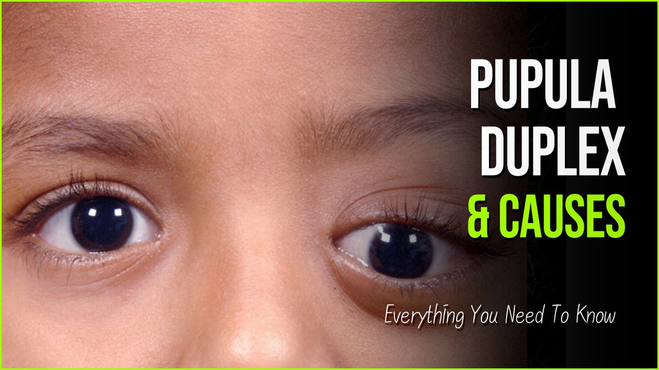 pupula duplex.jpg?fit=1024%2C576&ssl=1&strip=all - Pupula Duplex And Other Eye Disorders That Internet Is Talking About