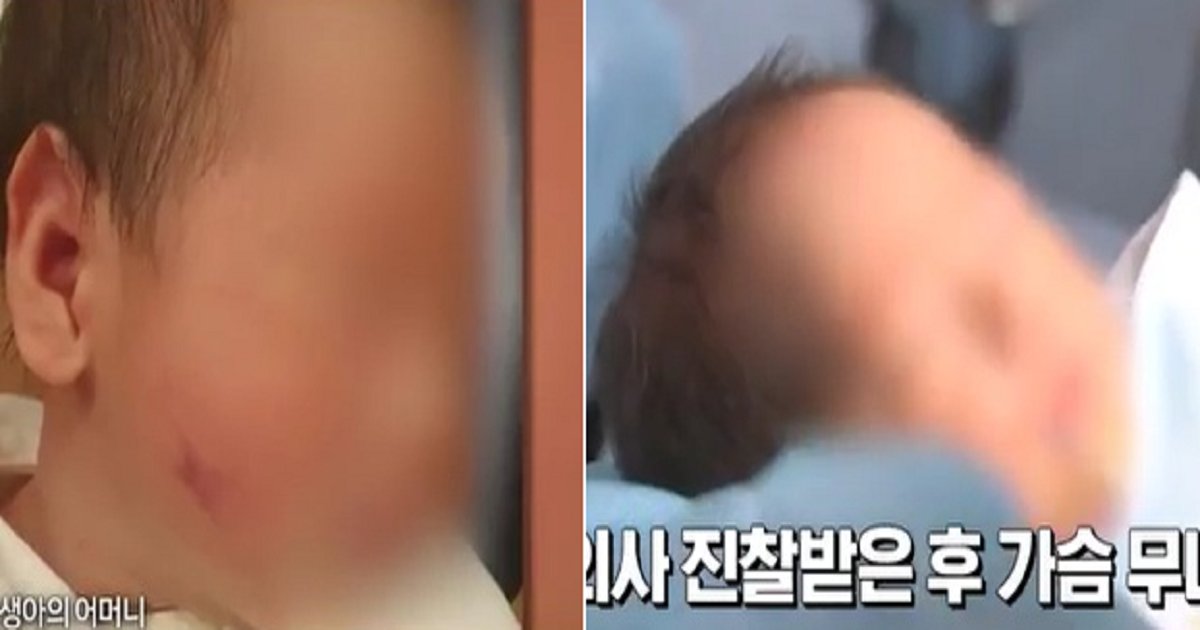 22222.png?resize=412,232 - 신생아 얼굴에 피멍 생기게 한 산후조리원