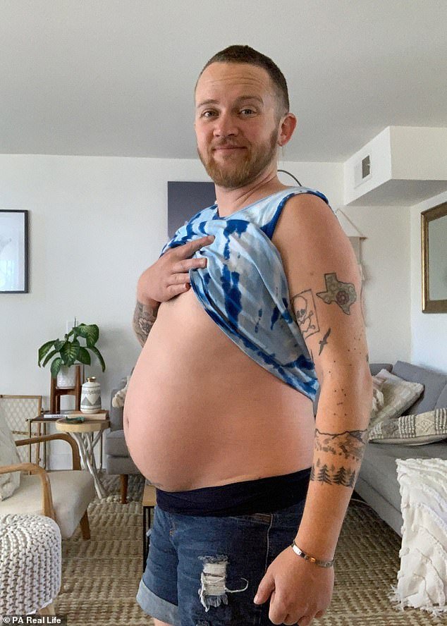 Transgender man