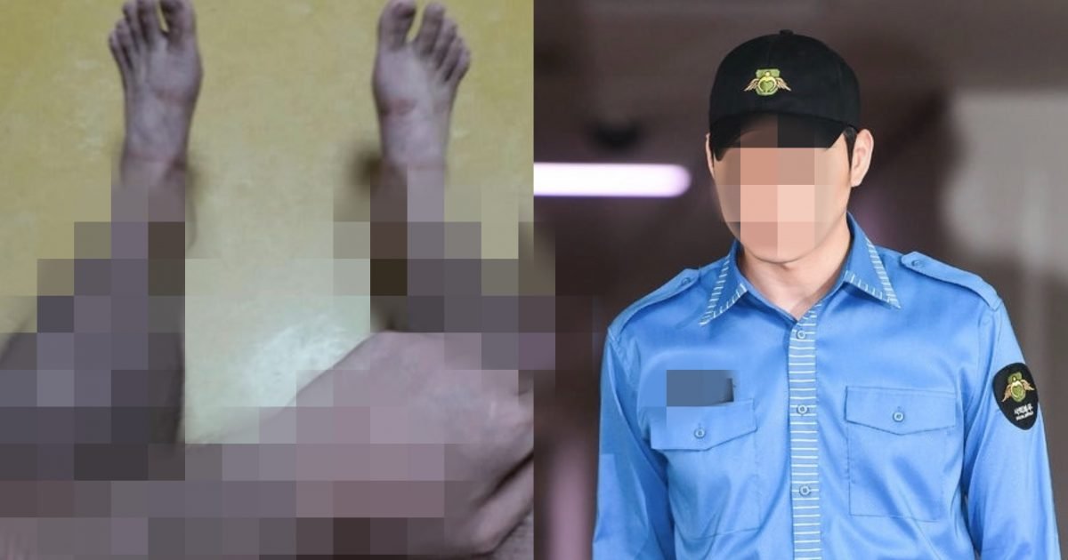487e5263 5218 41e8 b235 589b7fb78a1c e1599018287557.jpg?resize=412,232 - “세상에, ‘털’ 때문에 4급 판정을?”…털 때문에 군대 공익 판정받은 남성의 ‘충격적인’ 털 상태.jpg