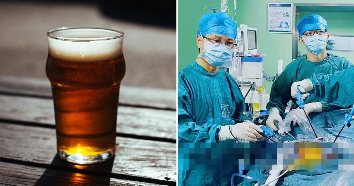beer.jpg?resize=412,275 - Man Needed Life-Saving Surgery After A Beer Glass Got Stuck In His Backside