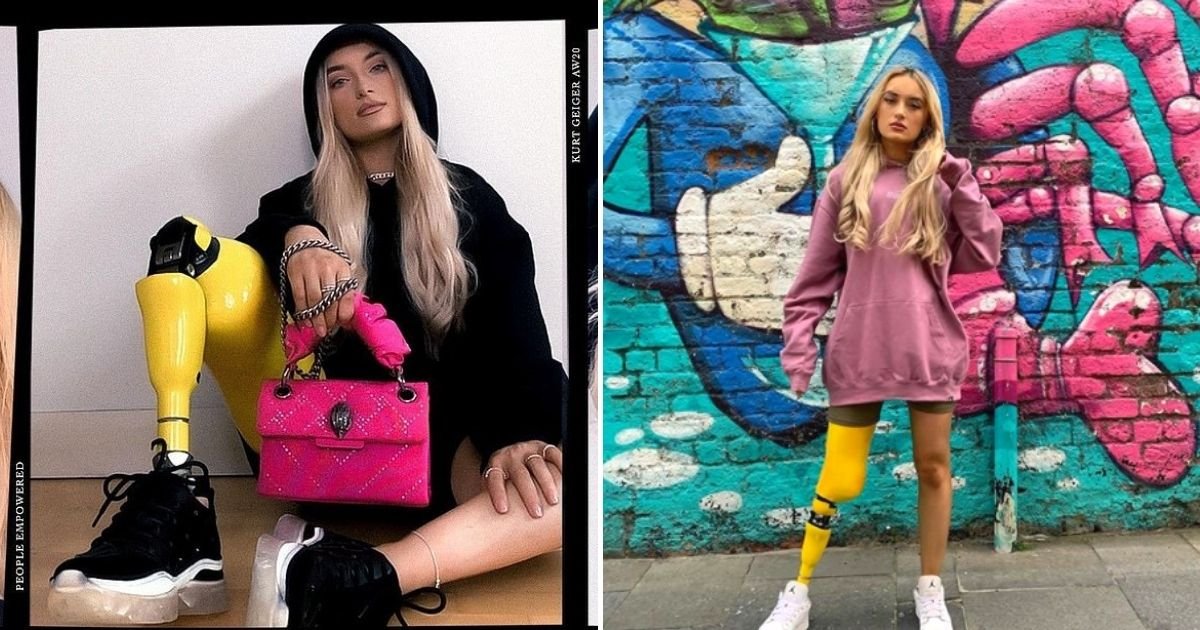 bernadette5.jpg?resize=412,232 - 24-Year-Old Woman Who Lost Her Leg To Cancer Is Now The New Face Of A Major Fashion Brand