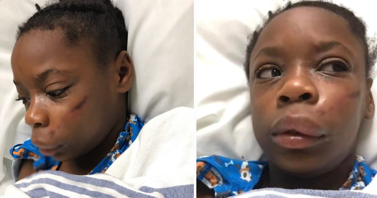 black girl.jpg?fit=1024%2C538&ssl=1&strip=all - Racist Attack Turns Brutal As Black Girl Hospitalized After Being Slammed With Metal Pole