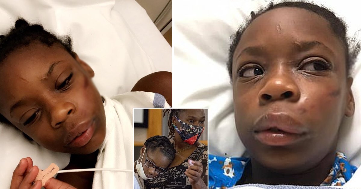 girl attack.jpg?resize=1200,630 - Racist Attack Leaves Young Black Girl Hospitalized After Being Slammed With Metal Pole