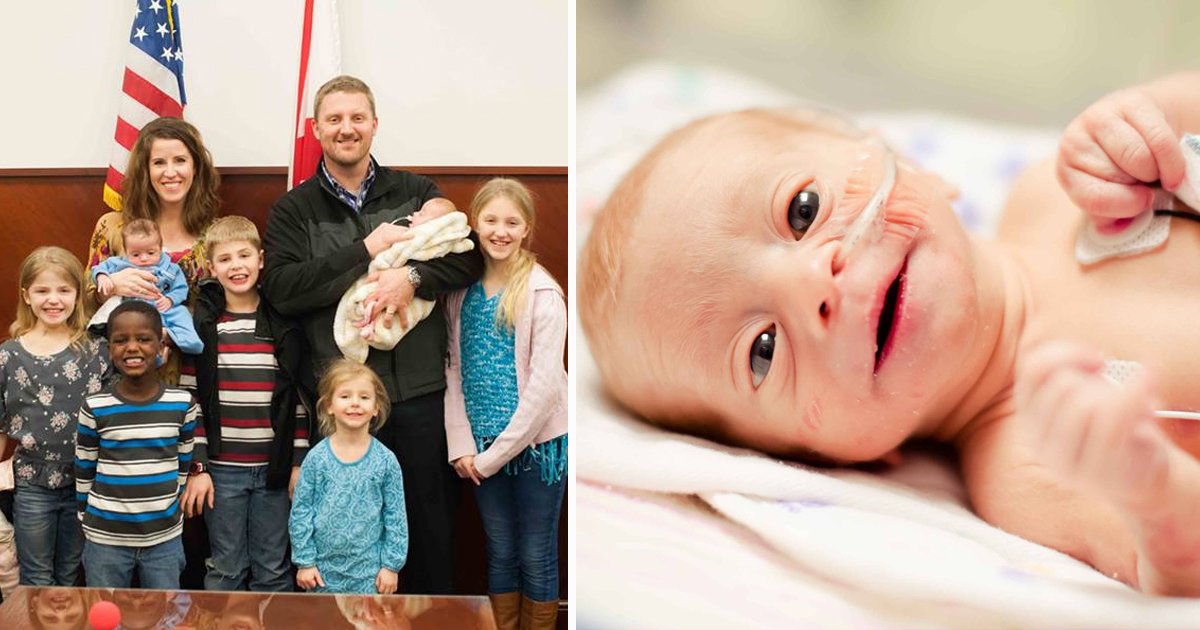 gsdfs.jpg?fit=1024%2C538&ssl=1&strip=all - When No One Else Would, This Couple Adopted A Baby Born Without A Brain