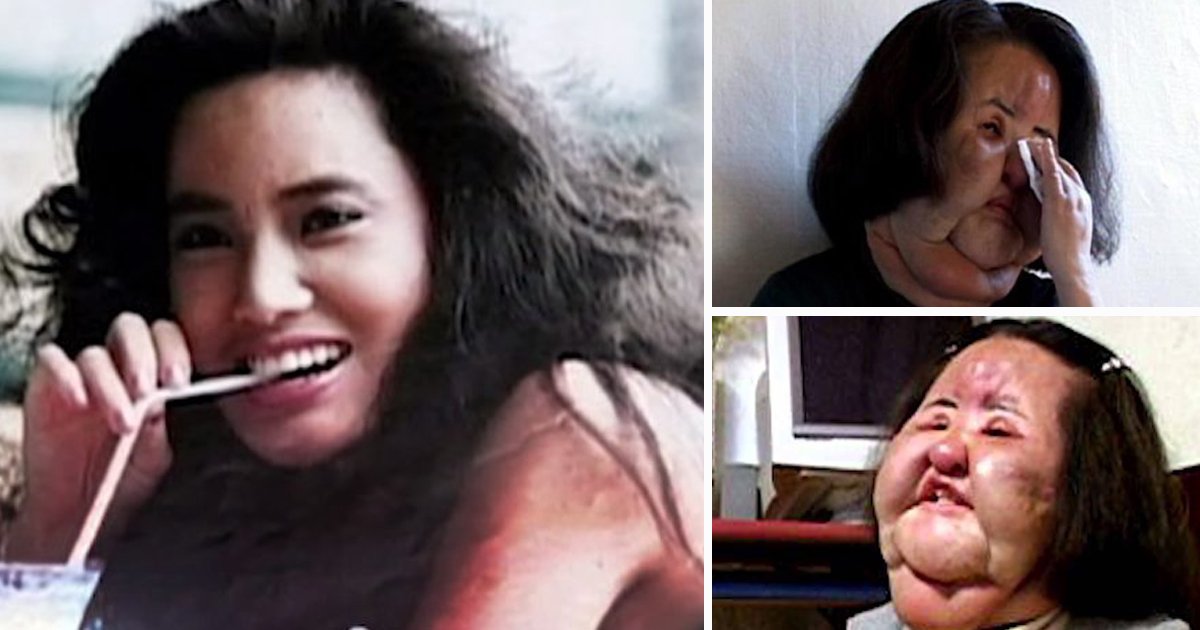 gsfsdf.jpg?resize=412,275 - Korean Model Hang Mioku's Ugly Transformation After Surgeries