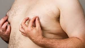 twisted nipples