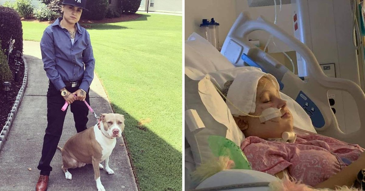 sdfsdfsdss.jpg?fit=1024%2C538&ssl=1&strip=all - Vicious Pit Bull Attack Lands Teen In Coma With Torn Open Scalp. Damaged Throat, And Ear