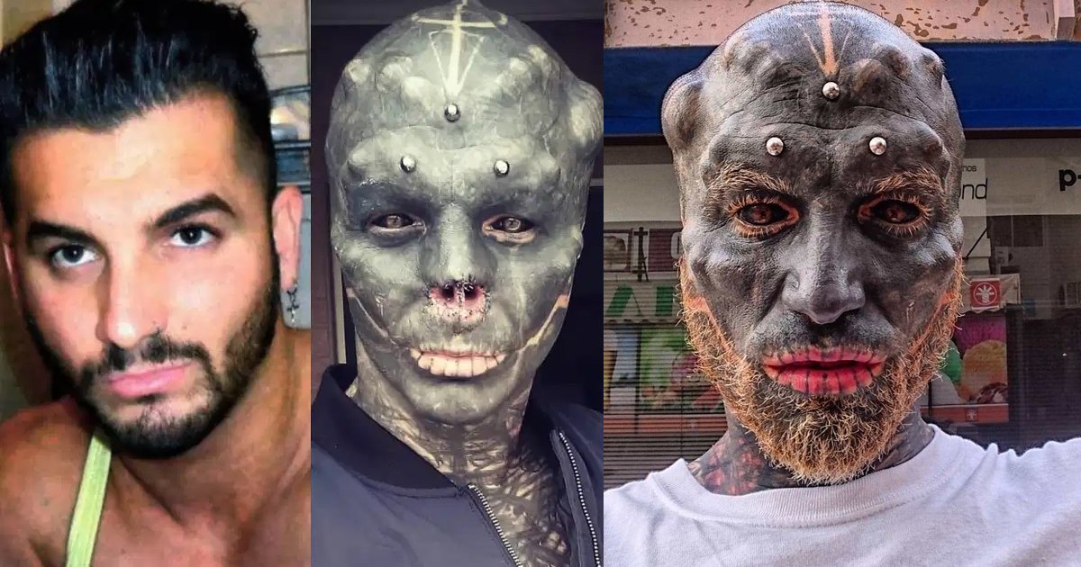 ssdfsdf.jpg?fit=1024%2C538&ssl=1&strip=all - Man Gets His Nose Removed As He Transforms Himself Into 'Black Alien'