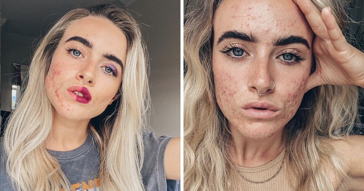 vonjour4 1.jpg?resize=412,275 - Une influenceuse dévoile sa peau sans maquillage sur Instagram