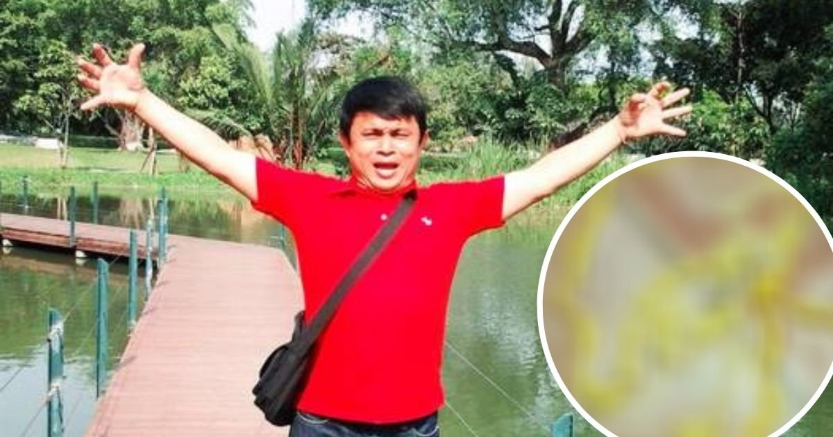 worm4.jpg?resize=412,275 - Man Pulled Out 17ft Tapeworm From His Rear End And Shared A Video Of His 'Wriggling' Discovery