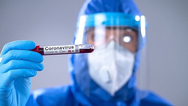 Tratamiento de la covid-19: qué son los anticuerpos monoclonales y por qué podrían ser una alternativa contra el coronavirus hasta que haya vacuna - BBC News Mundo