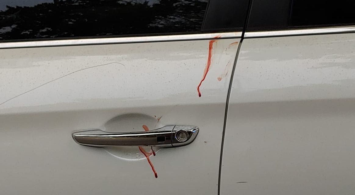 Manchas de sangre en su auto lo delatan al huir | LectorMx