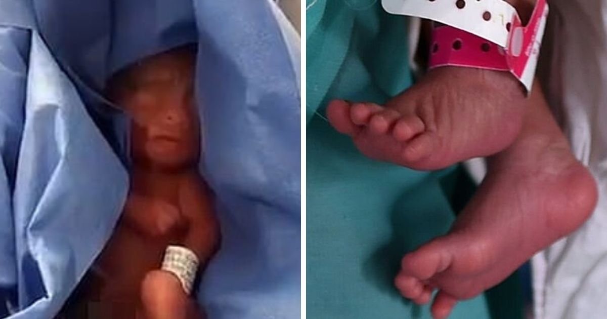 baby5 1.jpg?resize=412,275 - Baby Survives Six Hours In Morgue Refrigerator After Being Mistakenly Declared Dead