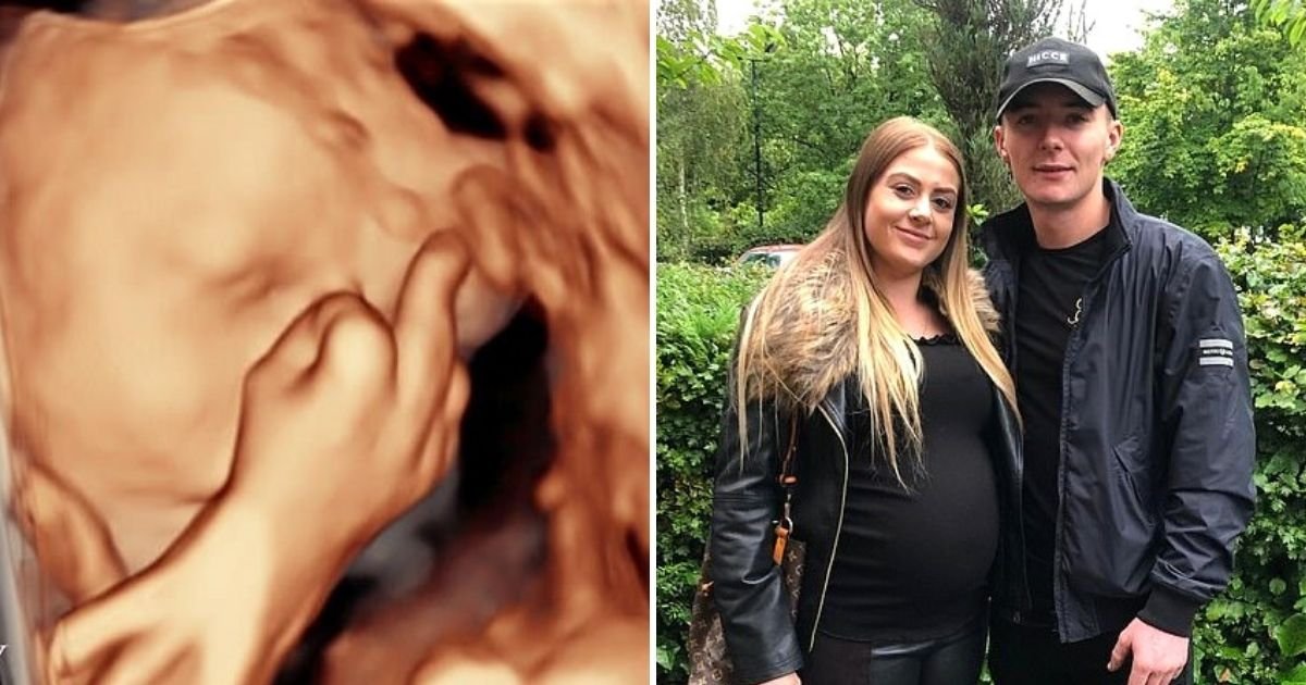 baby5.jpg?resize=412,275 - Parents In Hysterics When Unborn Baby Boy Gives Them The Middle Finger During A Scan