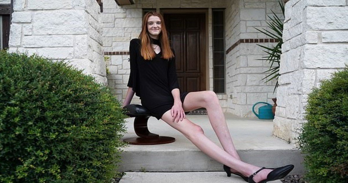 e18486e185aee1848ce185a6 2020 10 12t014244 965.jpg?resize=1200,630 - Meet The 17-Year-Old Woman Who Has The Longest Legs In The World